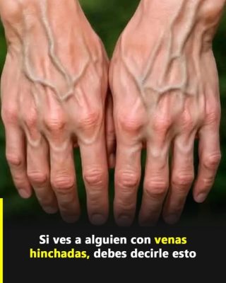 ¿Tus venas se ven más de lo normal? Esto es lo que tu cuerpo podría estar tratando de decirte