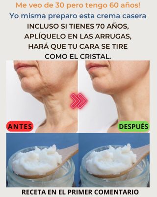 Prepara la crema, de bicarbonato, ponla antes de dormir. Adiós arrugas y manc..ver mas. Para seguir recibiendo mis recetas, solo debes decir algo… ¡Gracias!