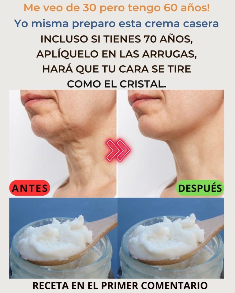 Prepara la crema, de bicarbonato, ponla antes de dormir. Adiós arrugas y manc..ver mas. Para seguir recibiendo mis recetas, solo debes decir algo… ¡Gracias!