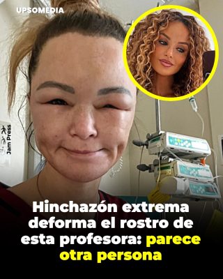 Cuando el cuerpo cambia sin aviso: la lucha silenciosa de Claire Titterington