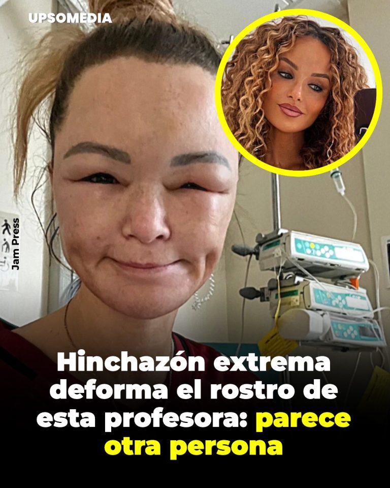 Cuando el cuerpo cambia sin aviso: la lucha silenciosa de Claire Titterington