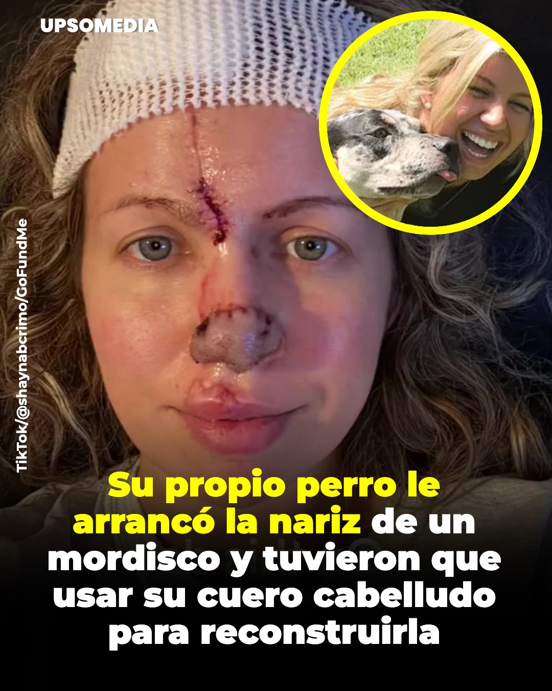Cuando el amor y el peligro se cruzan: la historia de Shayna Crimo y su inesperada lucha por reconstruirse