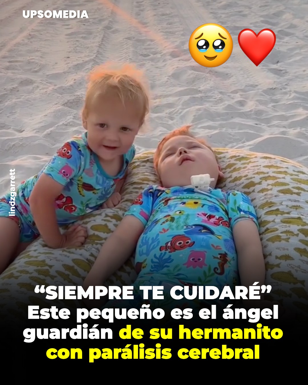 Un amor sin límites: la lección de dos hermanos que conmueve al mundo 💛