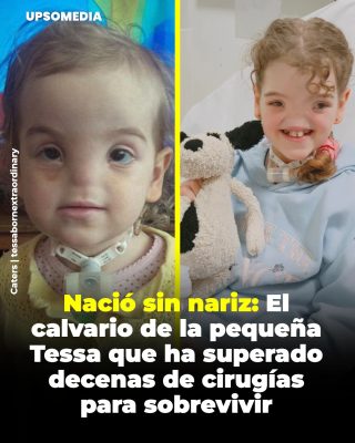 Tessa Evans nació con una condición extremadamente rara llamada arrinia completa congénita,
