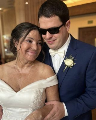 Me casé con un hombre ciego para que nunca viera mis cicatrices – En nuestra noche de bodas, él dijo: “Necesitas saber la verdad que he estado ocultando durante 20 años”. onMay 9, 2026